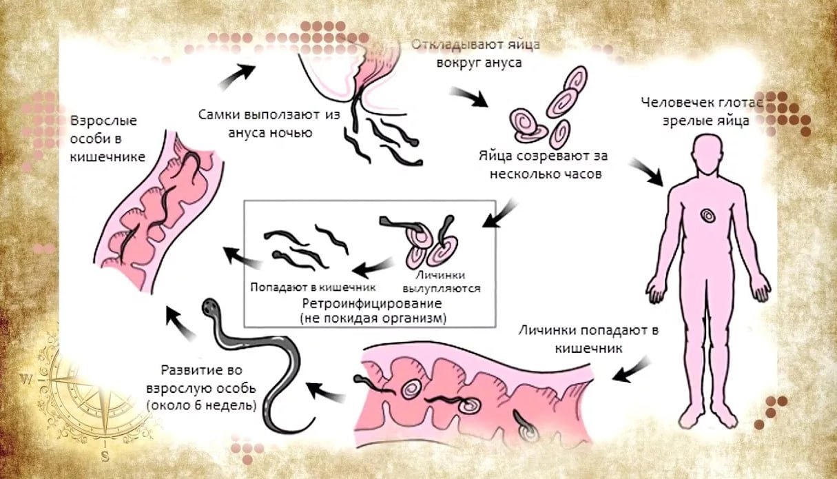 Энтеробиоз. Важное о главном..